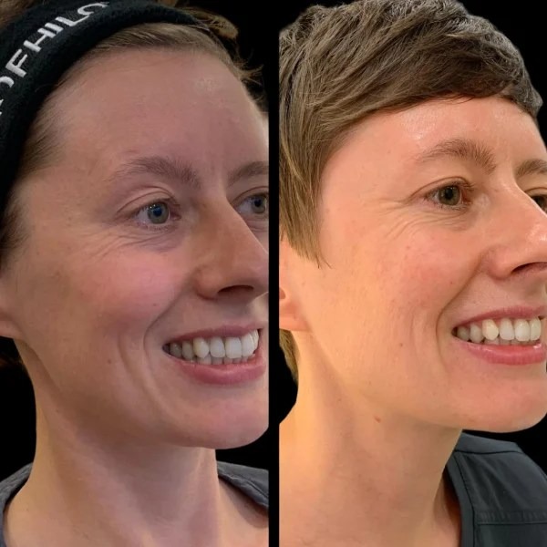 Best Aesthetic Clinic in dubai