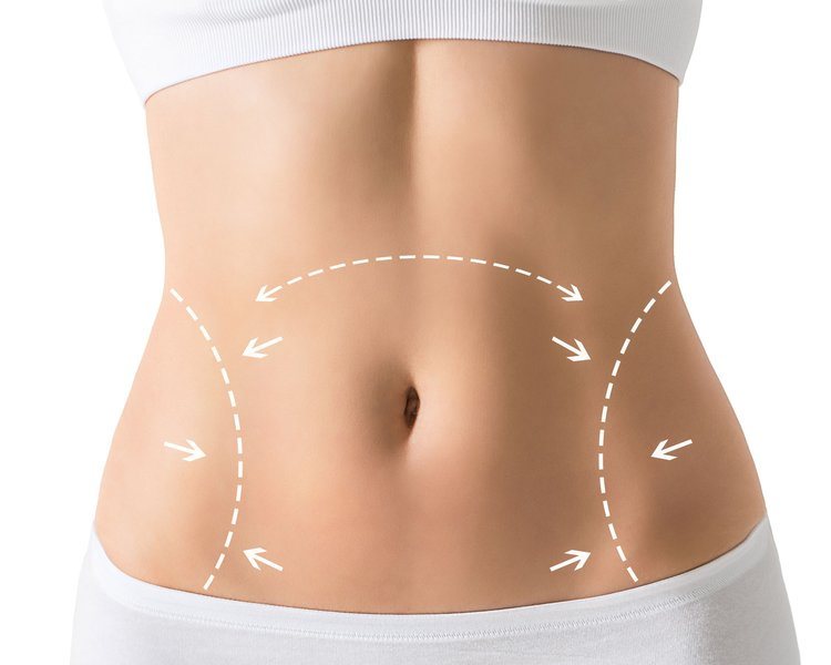 Why Fat Transfer in Dubai Is a Natural Alternative to Fillers